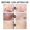 West & Month Blackhead Mud Mask Oil Control Pore Refining Cleanser