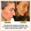 Clay Face Mask Deep Cleansing Oil Control Pore Care