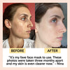 Clay Face Mask Deep Cleansing Oil Control Pore Care